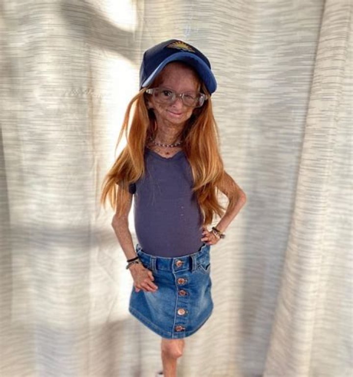 Adalia Rose (facebookstar) Wiki,Age,Birthday,Biography,Height,Net Worth ..
